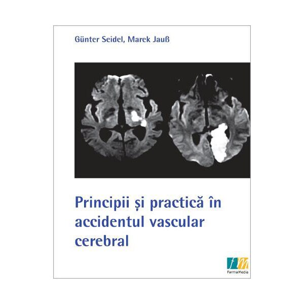 Principii Si Practica In Accidentul Vascular Cerebral Marek Jaus