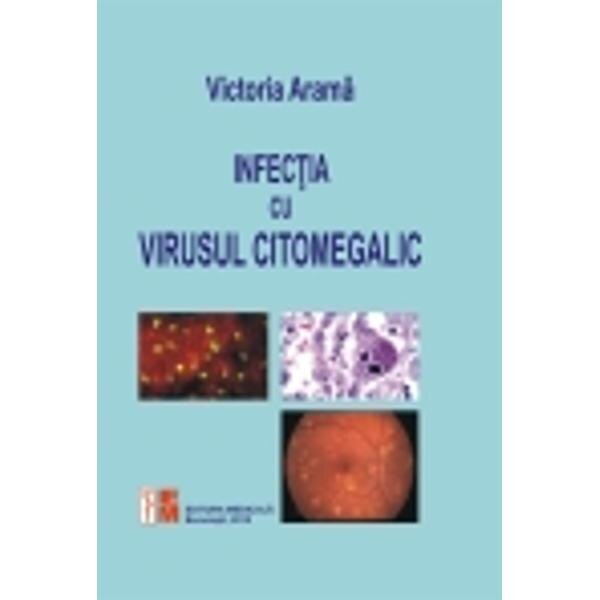 Infectia Cu Virusul Citomegalic Victoria Arama EMAG Ro