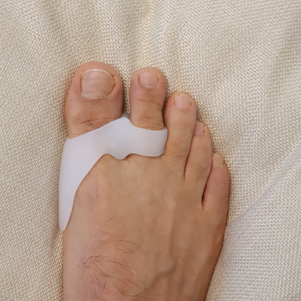 noduli la degetele de la picioare articulații dureroase la genunchi