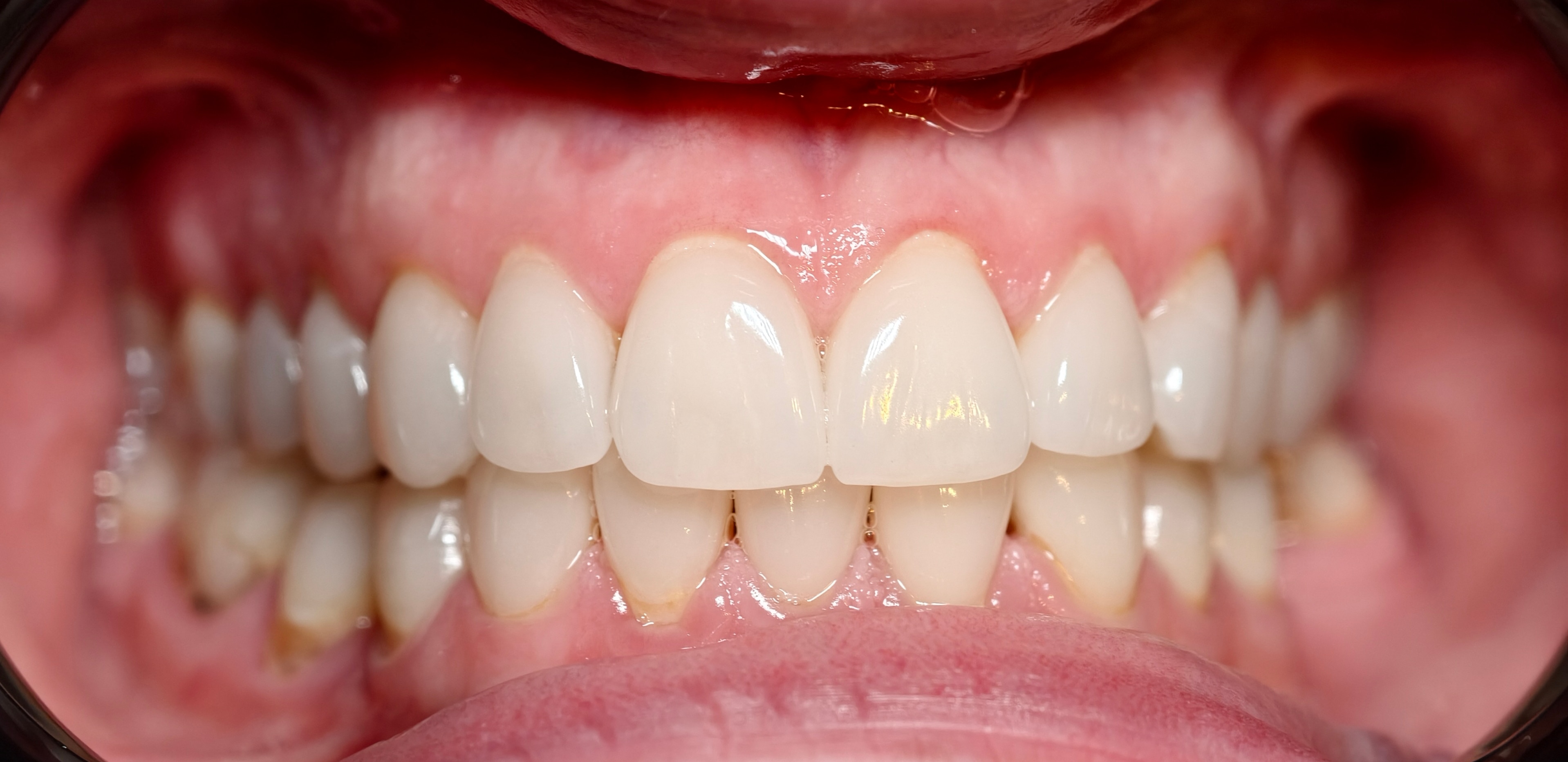 Telefon mobil Vivo X200 Pro, 16GB RAM, 512GB, 5G, Titanium