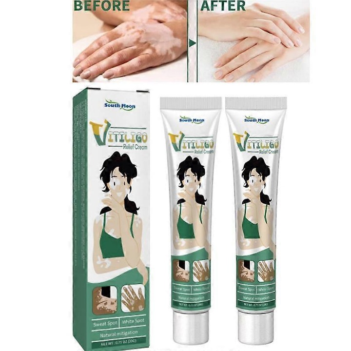 2x Vitiligo javító krém szett, 20g, 13x3x2cm, természetes formula
