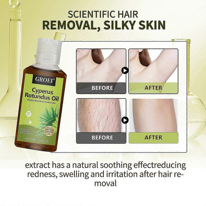 Set 5 sticle Ulei de Cyperus Rotundus pentru Epilare, 50ml