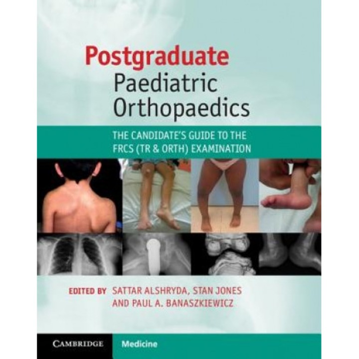 Postgraduate Paediatric Orthopaedics: The Candidate's Guide to the Frcs (Tr and Orth) Examination - Sattar Alshryda (Editor)