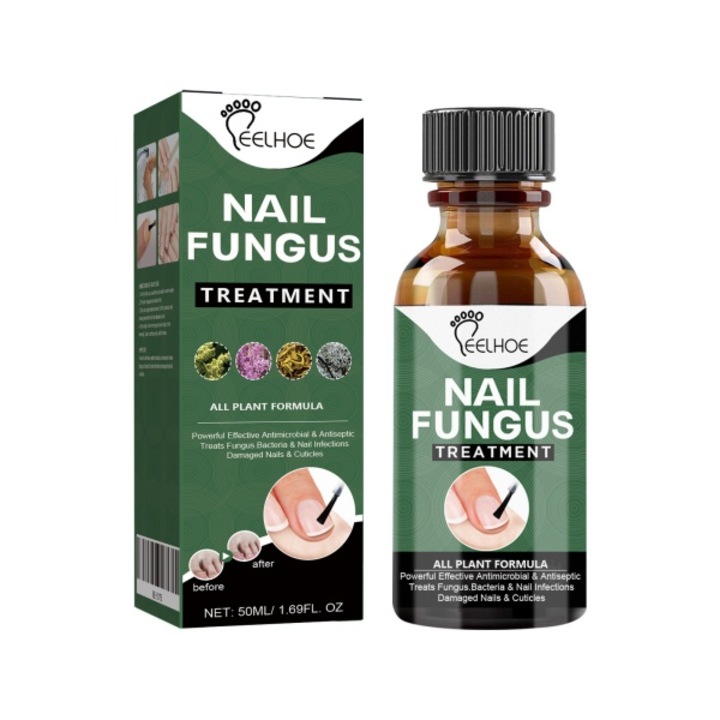 Екстра силна терапия на гъбички по ноктите на краката - бързо решение за дебели, счупени, обезцветени и увредени нокти, интензивно възстановяване, ефективна грижа и възстановяване на ноктите