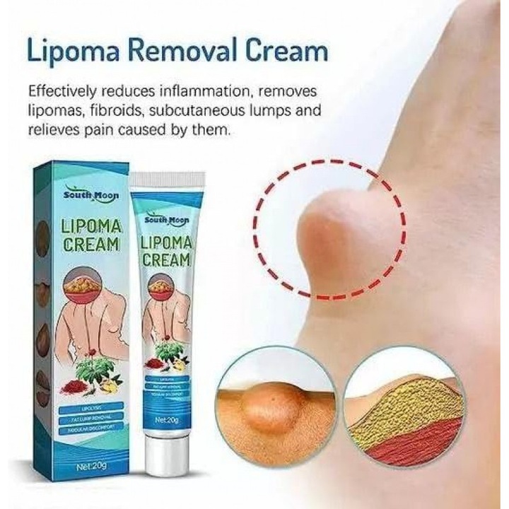 Crema de ingrijire a pielii South Moon 20g - Formula 2 in 1 cu extracte de ghimbir si Panax, pentru uniformitatea texturii pielii, fara durere si hipoalergenica produs cosmetic, Balsam de corp Unisex Corp Normal