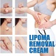 Crema de ingrijire a pielii South Moon 20g - Formula 2 in 1 cu extracte de ghimbir si Panax, pentru uniformitatea texturii pielii, fara durere si hipoalergenica produs cosmetic, Balsam de corp Unisex Corp Normal