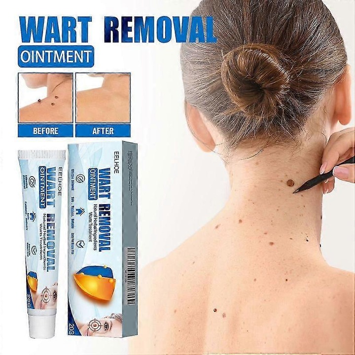 Ceainic cu fluier din otel inoxidabil, 2.5L, 22.5x19.5cm, negru, set