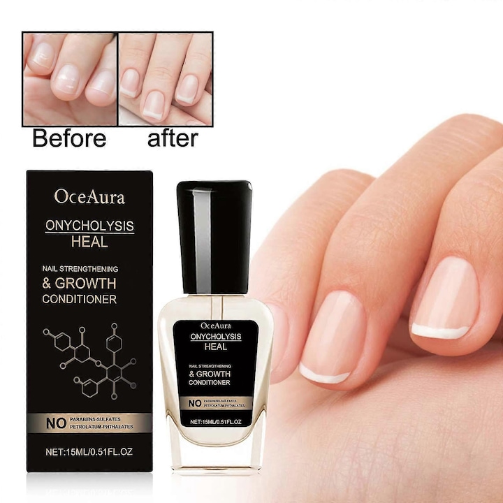 Condiment pentru intarirea si cresterea unghiilor, Onycholysis Heal, cu Biotina, 1pcs OCEAURA