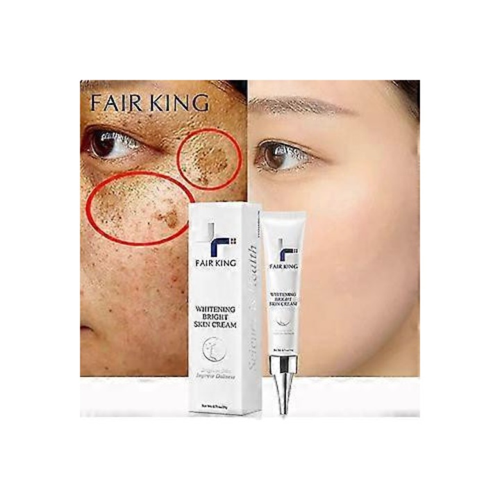 Fehérítő arckrém, 2025, sötét foltok eltávolítása, arcszín javítása, 50ml
