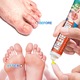Tratament Antifungic Rapid pentru Tinea Pedis - Crema & Peeling Combatere Mancarime Picioare, Eliminare Beriberi si Infectii Fungice la Picioarele Atletului, Actiune Intensa