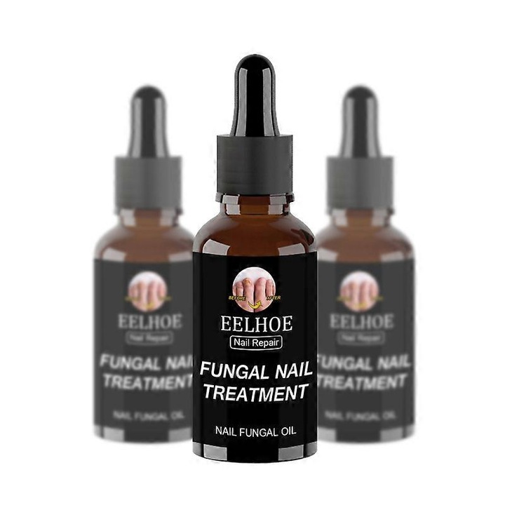 Ser tratament rapid pentru ciuperca unghiilor, Eelhoe, 3 buc, 30ml, esenta reparatoare pentru picioare