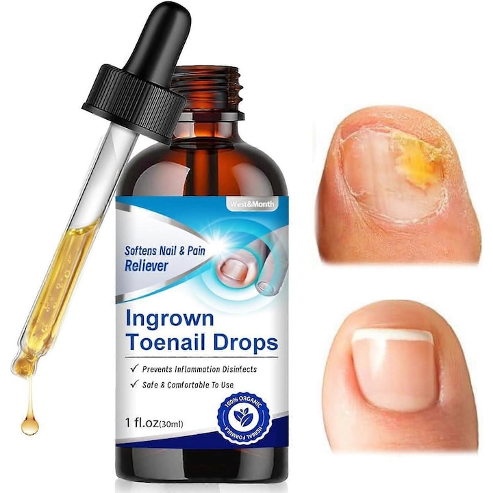 Solutie pentru unghii incarnate, tratament pentru unghii, ulei pentru cuticule, set 3 buc