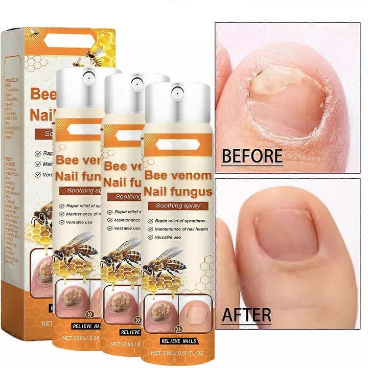 Méhméreg körömápoló spray, 20ml, 3 darabos szett, 2.6x2.6x10.3cm