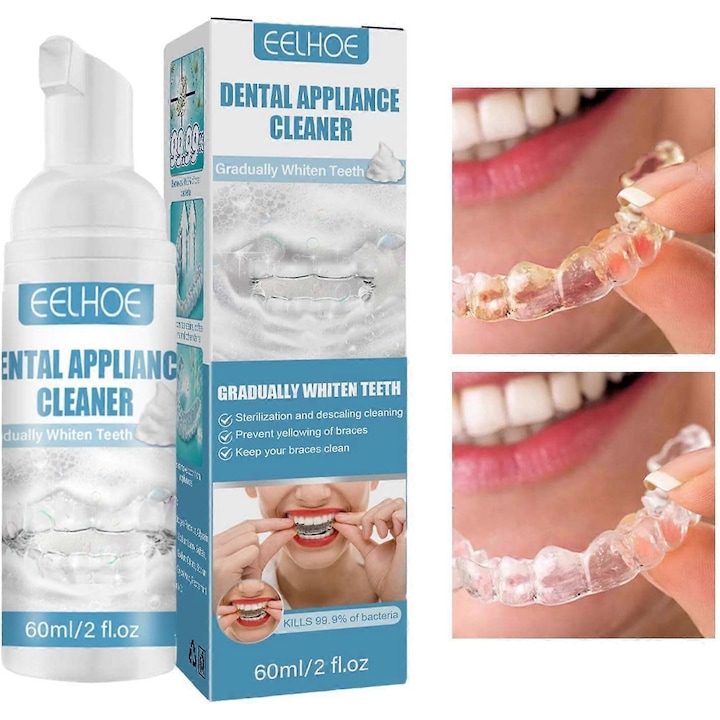 Set 3pcs Curatare Spuma pentru Aparat Dentar, Indepartare Pete, 2 Uncii, Multicolor