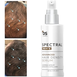 Spectral Men’s DNC-N Ser pentru Cresterea Parului cu Nanoxidil 5% – Tratament Avansat Anticadere, Formula Usoara pentru Barbati, cu Absorbtie Ridicata, pentru Stimularea Cresterii parului, Fara Parabeni si Sulfati, 60 ml