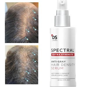 Spectral Extra Strength Ser Fortifiant cu Nanoxidil 7% – Tratament Avansat Impotriva Raririi si Subtierii Parului in Stadii Avansate, cu 3 Inhibitori DHT si 28 de Ingrediente Active, pentru Cresterea Parului, unisex, 60 ml