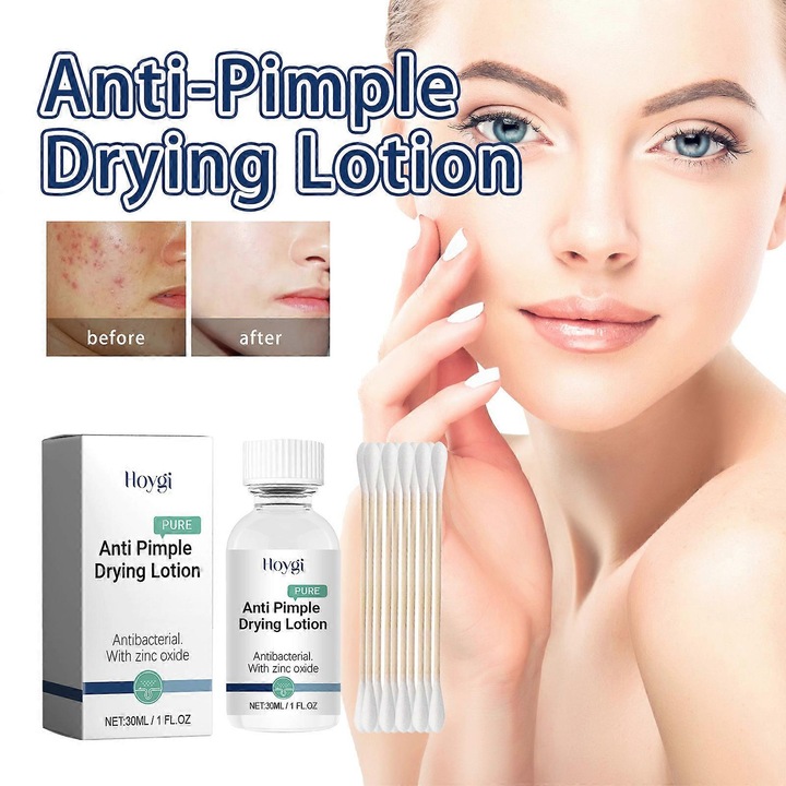 Lotiune anti-acnee, tratament cu oxid de zinc, AHA, set de 2