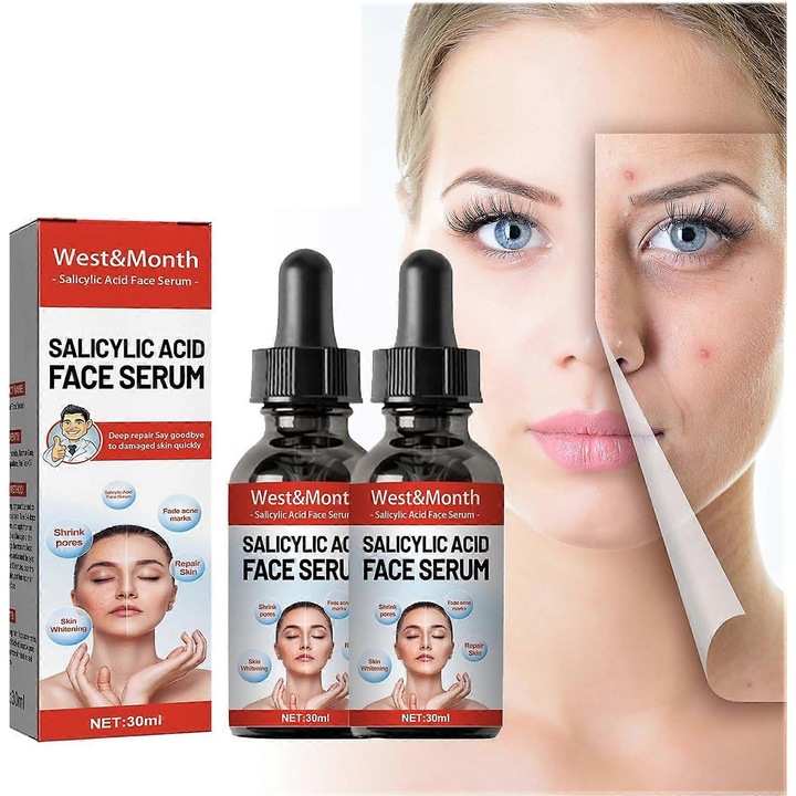 Ser facial cu acid salicilic, tratament anti-acnee, set 2 bucati, pentru ten gras, 30ml