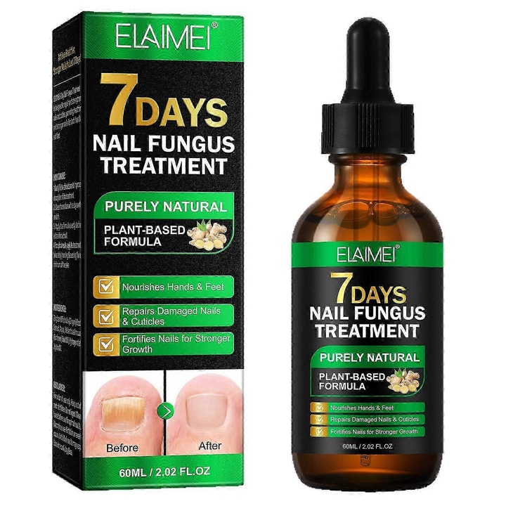 Serum pentru ingrijirea unghiilor cu ghimbir si turmeric, tratament anti-ruptura, 15ml