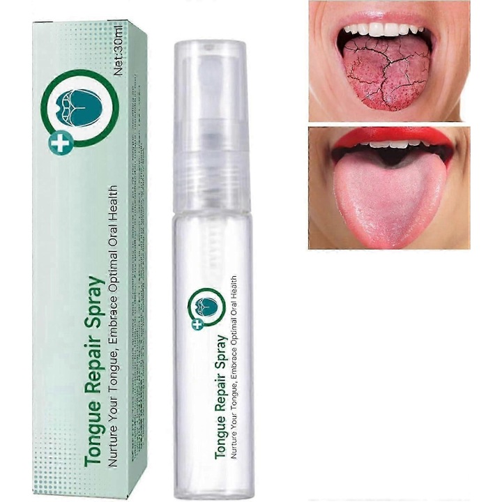 Спрей за възстановяване на езика, моментална хидратация, премахване на неприятна миризма, 1 брой