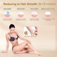 Epilator IPL pentru Epilare Permanenta Acasa, 5 Niveluri de Intensitate, Tehnologie Lumina Pulsata, Fara Durere, pentru Fata, Axile, Picioare si Corp, pentru Femei si Barbati, Alb