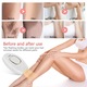 Epilator IPL pentru Epilare Permanenta Acasa, 5 Niveluri de Intensitate, Tehnologie Lumina Pulsata, Fara Durere, pentru Fata, Axile, Picioare si Corp, pentru Femei si Barbati, Alb