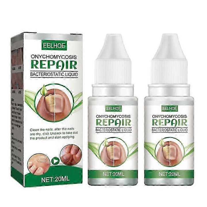 Onychomycosis körömjavító oldat, Eelhoe 20ml, körömgomba kezelés, biztonságos és könnyen használható, 2 db