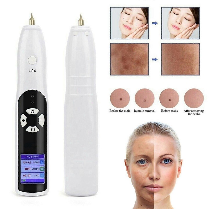Pen Plasma Fibroblast pentru Riduri, Lifting Pleoape, Intarire Piele, Alb