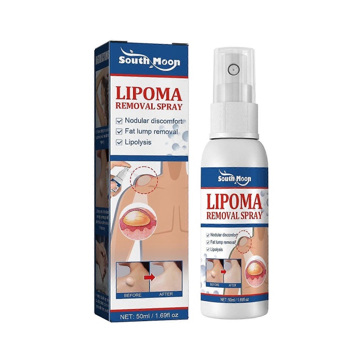 Spray pentru indepartarea lipoamelor, tratament antiinflamator, crema, usor de absorbit, 50ml