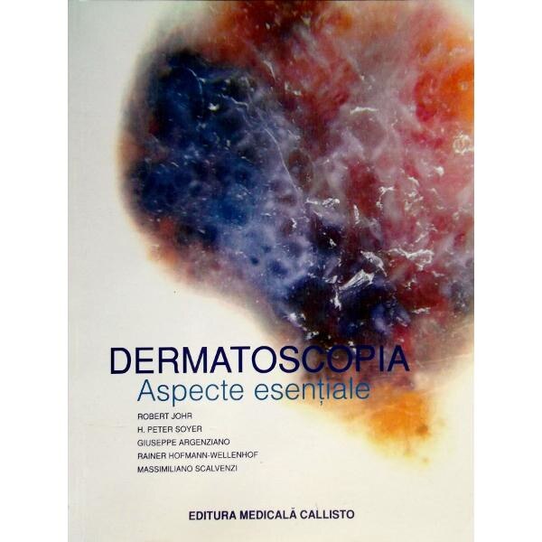 Dermatoscopia. Aspecte esentiale - Robert Johr, H. Peter Soyer