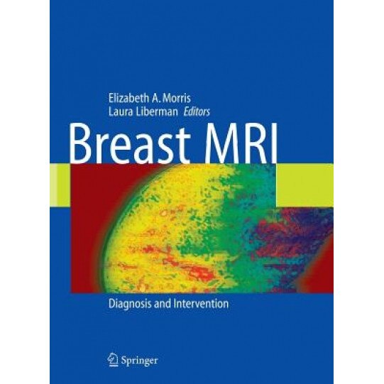 Breast MRI: Diagnosis and Intervention, Elizabeth Morris (Author)