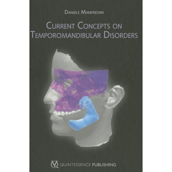Current Concepts on Temporomandibular Disorders - Daniele Manfredini (Author)