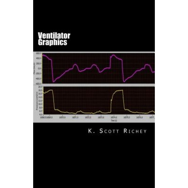 Ventilator Graphics: Identifying Patient Ventilator Asynchrony and Optimizing Settings, K. Scott Richey (Author)
