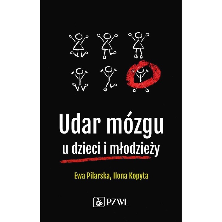 Инсулт при деца и юноши