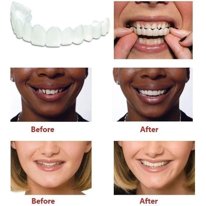 Set proteze dentare, Perfect Smile, 2 bucati, silicon, unisex, dimensiune completa, culoare: conform imaginii