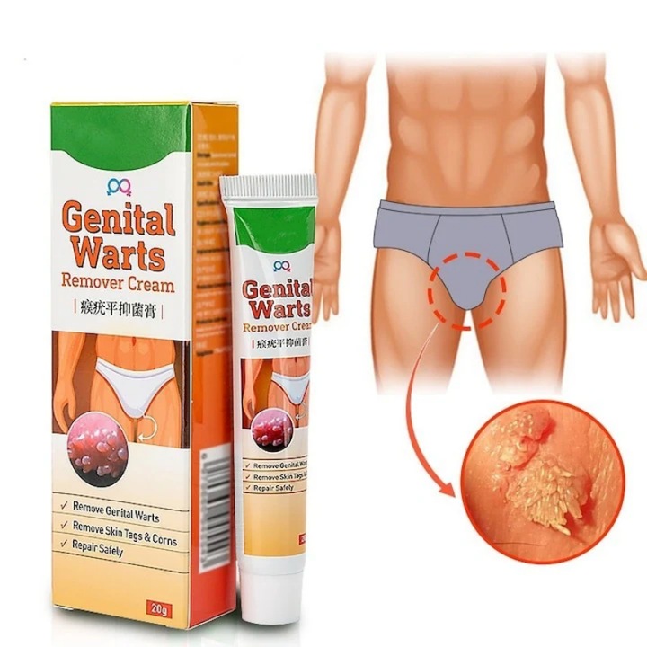 Crema pentru indepartarea negilor, pentru negi si papiloame AjieQaQ Eficienta in mod natural, indeparteaza rapid toate alunitele/negii/bataturile de pe picioare Potrivita pentru toate varstele, atat pentru barbati, cat si pentru femei 20 g