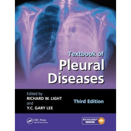 Textbook of Pleural Diseases, Third Edition - Richard W. Light (Editor)
