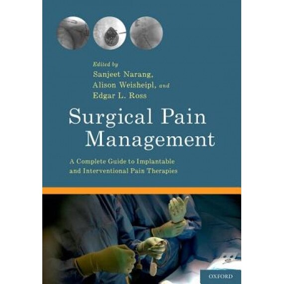 Surgical Pain Management: A Complete Guide to Implantable and Interventional Pain Therapies, Sanjeet Narang (Editor)