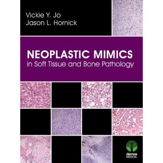 Neoplastic Mimics in Soft Tissue and Bone Pathology - Vickie Y. Jo (Author)