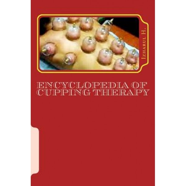 Encyclopedia of Cupping Therapy: Al-Hijama - Izharul H (Author)