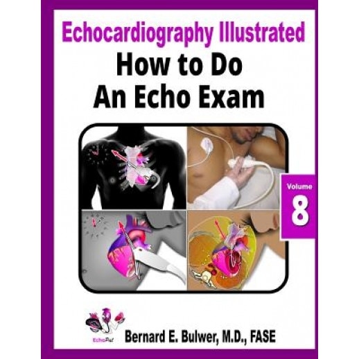 How to Do an Echo Exam - Bernard E. Bulwer MD (Author)