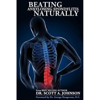 Beating Ankylosing Spondylitis Naturally, Scott A. Johnson (Author) Beating Ankylosing Spondylitis Naturally, Scott A. Johnson (Author)
