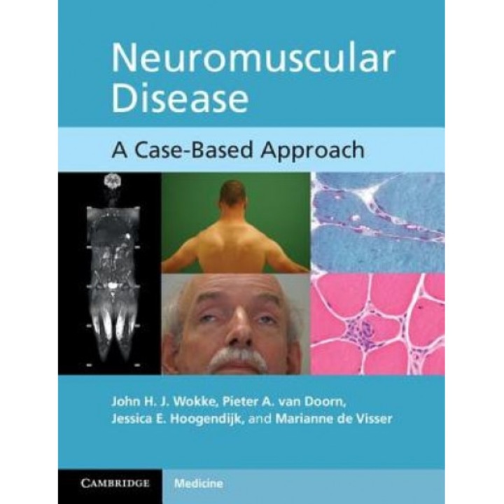 Neuromuscular Disease: A Case-Based Approach - John Wokke (Author)