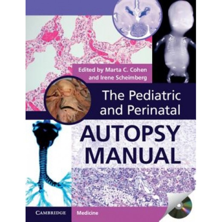 The Pediatric and Perinatal Autopsy Manual with DVD-ROM - Marta C. Cohen (Editor)