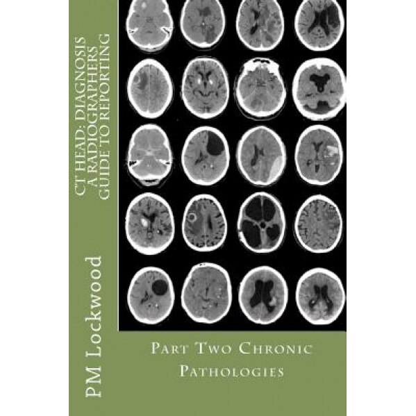 CT Head: Diagnosis a Radiographers Guide to Reporting Part 2 Chronic Pathologies: Part 2 Chronic Pathologies - P. M. Lockwood (Author)