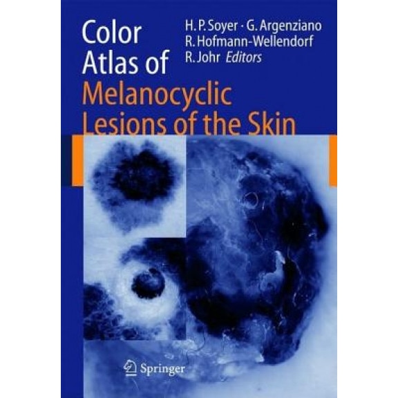 Color Atlas of Melanocytic Lesions of the Skin, H. Peter Soyer (Editor)