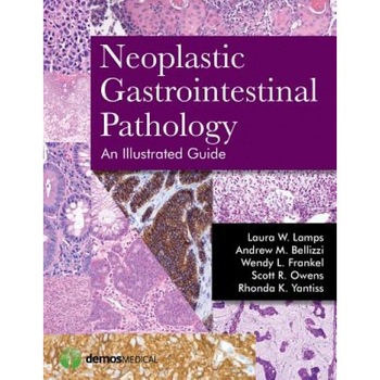 Neoplastic Gastrointestinal Pathology: An Illustrated Guide: An Illustrated Guide - Laura Lamps (Author) Neoplastic Gastrointestinal Pathology: An Illustrated Guide: An Illustrated Guide - Laura Lamps (Author)