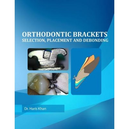 Orthodontic Brackets: Selection, Placement and Debonding, Dr Haris Khan (Author)