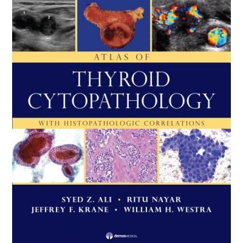 Atlas of Thyroid Cytopathology: With Histopathologic Correlations - Syed Z. Ali (Author)
