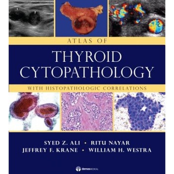 Atlas of Thyroid Cytopathology: With Histopathologic Correlations - Syed Z. Ali (Author) Atlas of Thyroid Cytopathology: With Histopathologic Correlations - Syed Z. Ali (Author)
